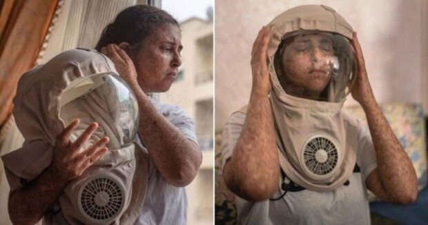 Marocká žena nosí skafandr kvůli vzácné sluneční alergii