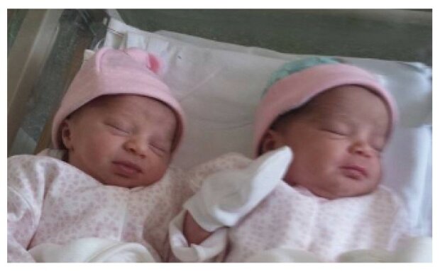 Žena porodila neobyčejná dvojčata: víme, proč jsou tak odlišná a proč je třeba to brát s klidem