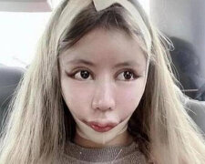 Číňanka utratila milion jüanů, aby se proměnila v panenku