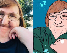 Jak žije Melissa Blakeová - žena s Freeman-Sheldonovým syndromem