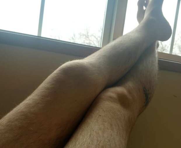 Nohy. Foto: snímek obrazovky lemurov.net