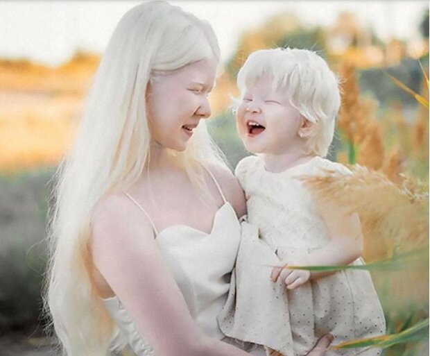 Sestry s albinismem fascinují svět svou krásou