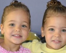 "První modelovou smlouvu dostaly, když jim bylo pouhých šest měsíců." V 7 letech byly dívky nazvaný nejkrásnějšími dvojčaty na světě. Jak vypadají teď