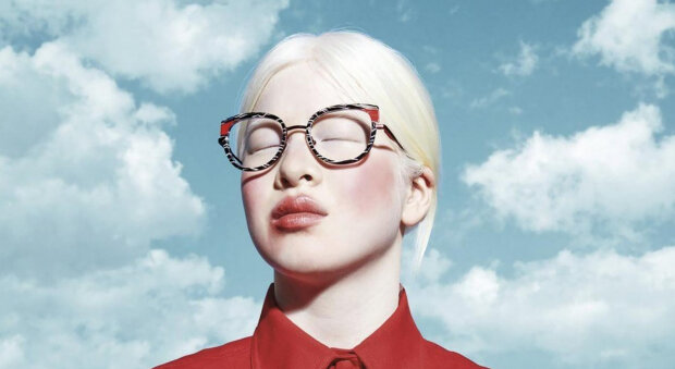 "V modelingu je albinismus výhodou": jak se dívka s albinismem z útulku stala populární modelkou