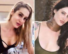 Američanka, který měl na krku prstenu 5 let, se rozhodl je sundat