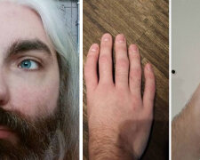 Lidé, kteří nejsou jako my: Mohou hrát ve filmech bez make-upu