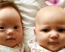 Dvojčata "jednou za milion": jedna se narodila "zvláštním", druhá ne