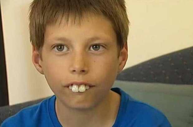 Jako teď vypadá teenager, který měl největší zuby na světě