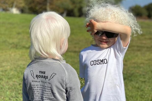 "Albíni nemají červené oči": Jak žena porodila dva albíny a nemohla uvěřit svému štěstí