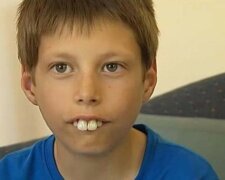 Jako teď vypadá teenager, který měl největší zuby na světě