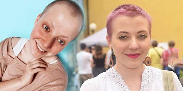 "Nemoc mi otevřela oči": po roce boje s rakovinou se Anička Slováčková podělila o výsledky