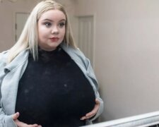 Žena, která žije se stále rostoucím poprsím. Léčení, které si nemůže dovolit. Prosba o pomoc
