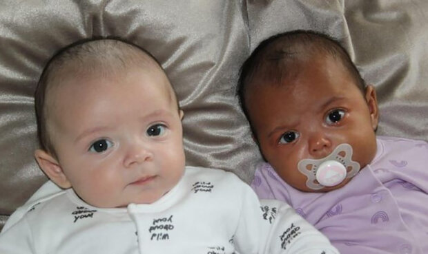 Žena porodila unikátní dvojčata s různou barvou pleti: "Případ jeden na milion"
