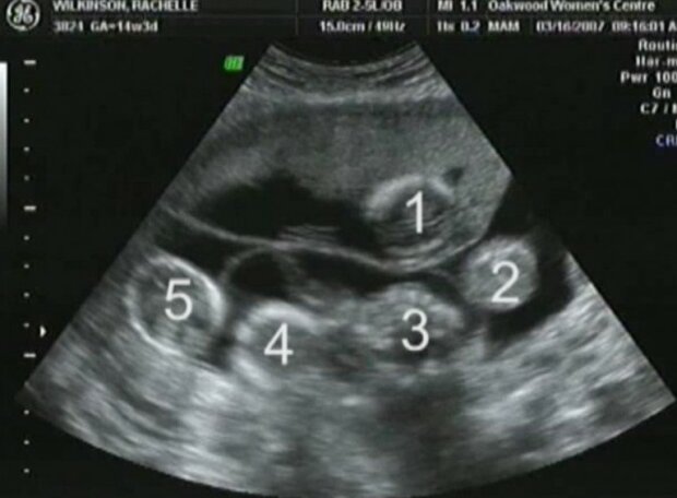 Fotografie: laykni.com