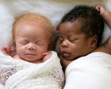 Fotografka porodila dvojčata různých barev pleti