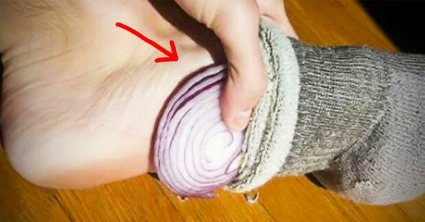 Co se stane, když do ponožky vložíte cibulový kroužek