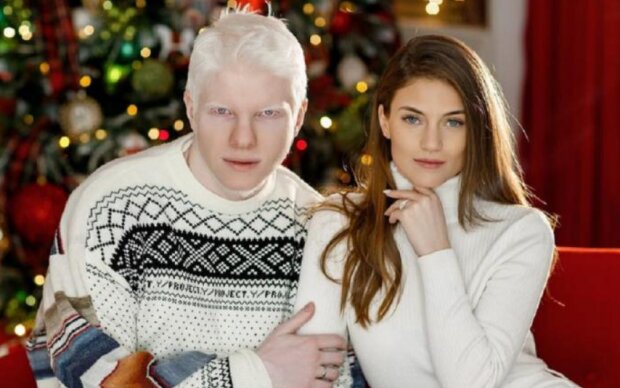 Albino model Bera Ivanishvili a jeho manželka, pár neobvyklých krás: „mají malé štěstí“