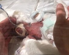Chlapec o hmotnosti dvě stě šedesát osm gramů byl propuštěn z nemocnice