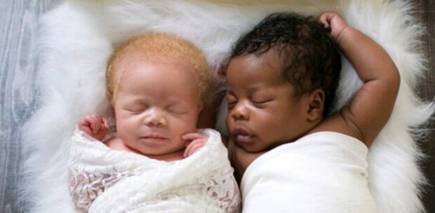 „Genetický zázrak“: dívka porodila krásná dvojčata s různou barvou pleti