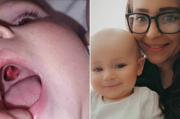 Mladá matka našla „díru“ v ústech svého syna a spěchala do nemocnice - problém byl vyřešen za 30 sekund