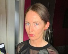 Žena se chtěla rychle  "opálit" a stala se pohádkovou postavou a na dlouhou dobu se vzdala svého záměru